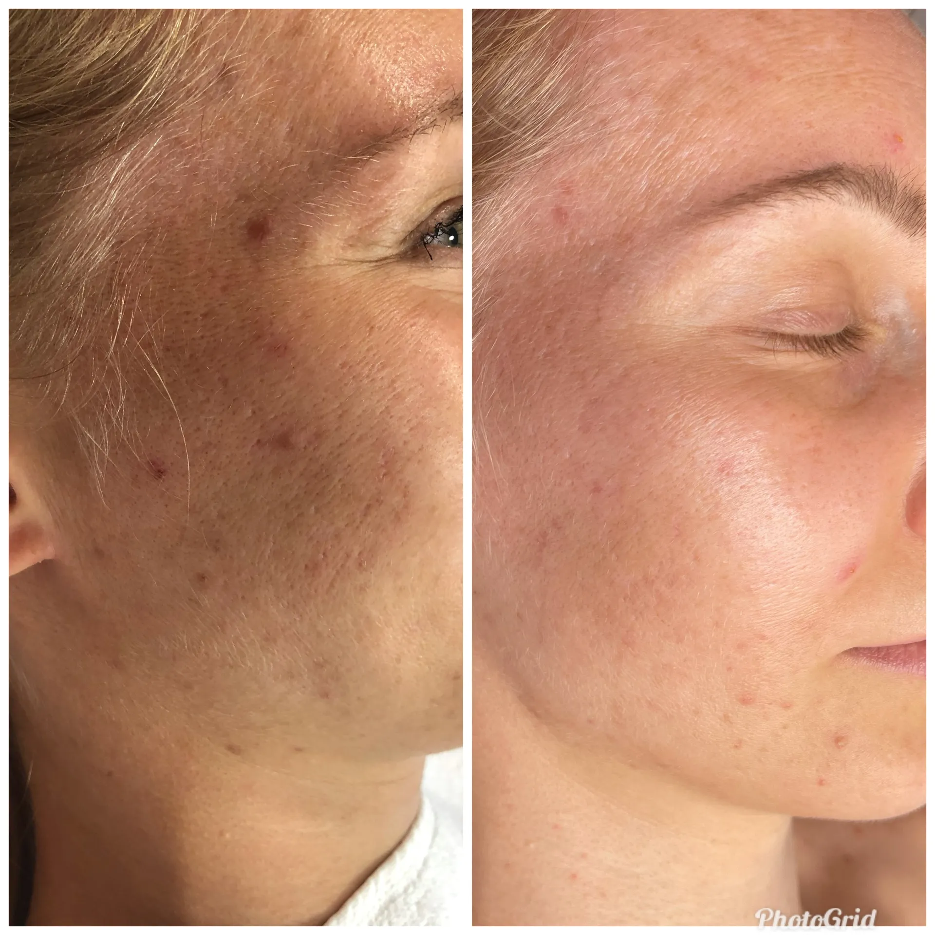Anti-Aging Behandlung Ergebnisse GUINOT Institut Berlin